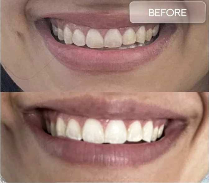 Whitening Toothpaste with Probiotic